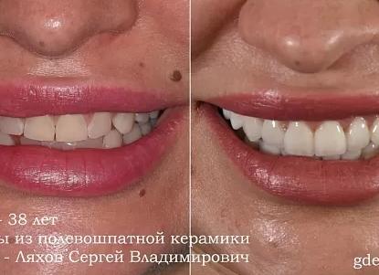 11 слов с проблемным «Е»: теперь вы будете писать правильно