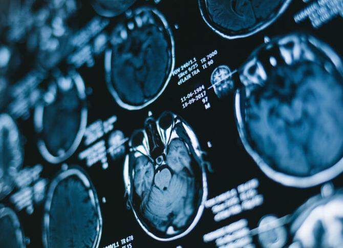 Ваш ум полон бесчисленных знаний, если ответите на 7/10. Тест на эрудицию